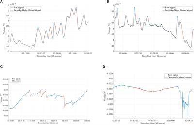 Using the electrodermal activity signal and machine learning for diagnosing sleep